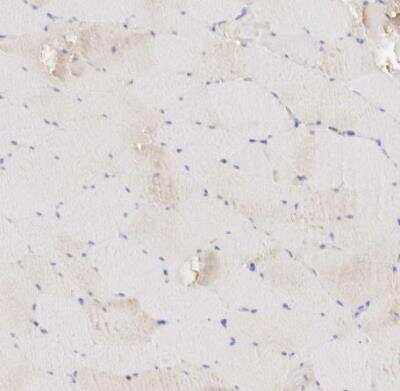 Immunohistochemistry-Paraffin: gamma-glutamyl hydrolase Antibody [NBP1-90927]