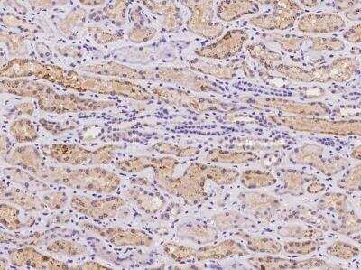 Immunohistochemistry-Paraffin: gamma-glutamyl hydrolase Antibody [NBP3-06418]