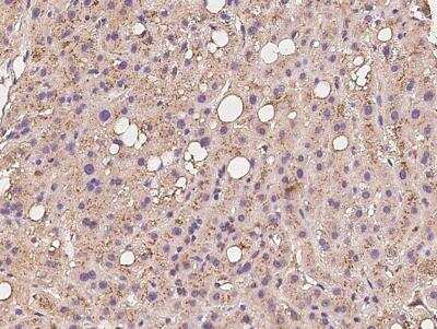 Immunohistochemistry-Paraffin: gamma-glutamyl hydrolase Antibody [NBP3-06418]