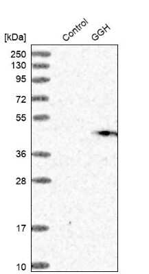 Western Blot: gamma-glutamyl hydrolase Antibody [NBP1-90927]