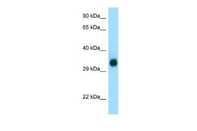 Western Blot: gamma-glutamyl hydrolase Antibody [NBP2-87485]