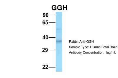 Western Blot: gamma-glutamyl hydrolase Antibody [NBP2-87485]