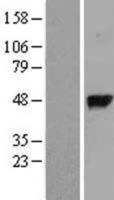 Western Blot: gamma-glutamyl hydrolase Overexpression Lysate [NBL1-11057]