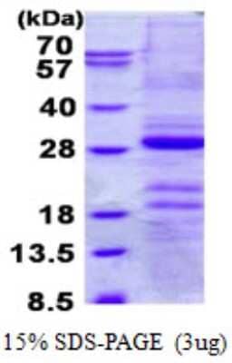 SDS-PAGE: Recombinant Human Gastrokine 1 His Protein [NBP2-23071]