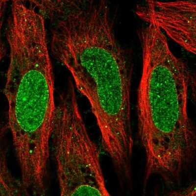 Immunocytochemistry/ Immunofluorescence: glutamine rich 2 Antibody [NBP2-56731]