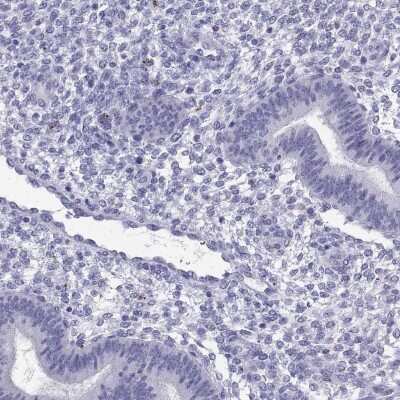 Immunohistochemistry-Paraffin: glutamine rich 2 Antibody [NBP2-56731]