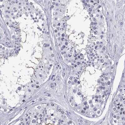 Immunohistochemistry-Paraffin: glutamine rich 2 Antibody [NBP2-56731]