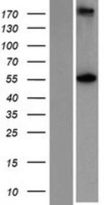 Western Blot: glutamine rich 2 Overexpression Lysate [NBP2-06073]