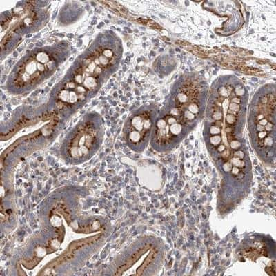 Immunohistochemistry-Paraffin: glycerol-3-phosphate permease Antibody [NBP1-87524]