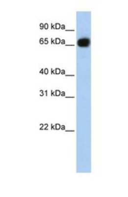 Western Blot: glycerol-3-phosphate permease Antibody [NBP1-69300]