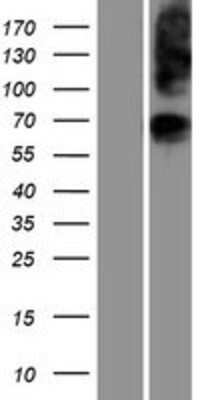 Western Blot: glycerol-3-phosphate permease Overexpression Lysate [NBP2-06750]