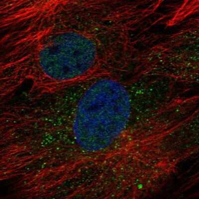 Immunocytochemistry/ Immunofluorescence: golgi transport 1 homolog B Antibody [NBP2-58644]