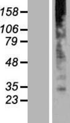 Western Blot: golgi transport 1 homolog B Overexpression Lysate [NBP2-07094]