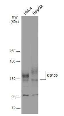 Western Blot: gp130/CD130 Antibody [NBP2-15776]