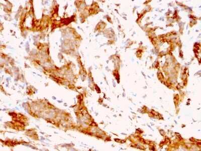 Immunohistochemistry-Paraffin: gp96/HSP90B1/GRP94 Antibody (9G10.F8.2) - IHC-Prediluted [NBP2-48046]