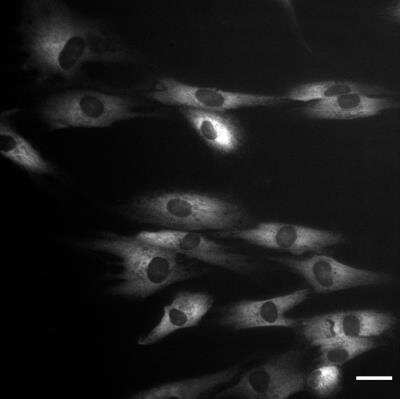 Immunocytochemistry/ Immunofluorescence: gp96/HSP90B1/GRP94 Antibody (9G10) [NB300-619]