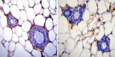 Immunohistochemistry-Paraffin: gp96/HSP90B1/GRP94 Antibody (9G10) [NB300-619]