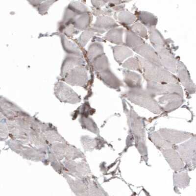 Immunohistochemistry-Paraffin: gp96/HSP90B1/GRP94 Antibody (CL2647) [NBP2-42379]