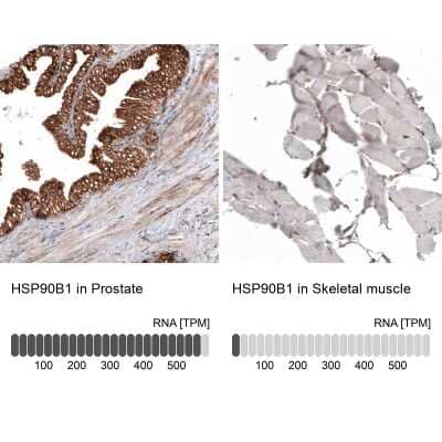 Immunohistochemistry-Paraffin: gp96/HSP90B1/GRP94 Antibody (CL2647) [NBP2-42379]