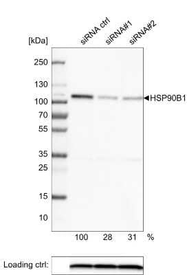 Western Blot: gp96/HSP90B1/GRP94 Antibody (CL2647) [NBP2-42379]