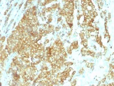 Immunohistochemistry-Paraffin: gp96/HSP90B1/GRP94 Antibody (HSP90B1/1192) - IHC-Prediluted [NBP2-48052]