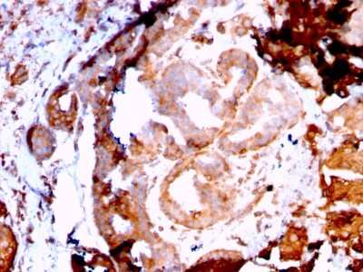 Immunohistochemistry-Paraffin: gp96/HSP90B1/GRP94 Antibody (HSP90B1/3168R) - Azide and BSA Free [NBP3-08763]