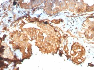 Immunohistochemistry-Paraffin: gp96/HSP90B1/GRP94 Antibody (HSP90B1/3168R) - Azide and BSA Free [NBP3-08763]