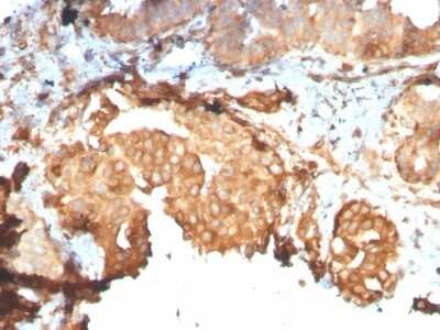 Immunohistochemistry-Paraffin: gp96/HSP90B1/GRP94 Antibody (HSP90B1/3168R) [NBP3-07740]