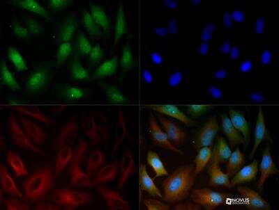 Immunocytochemistry/ Immunofluorescence: gp96/HSP90B1/GRP94 Antibody [NBP2-24698]