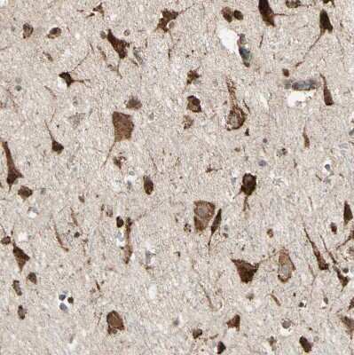Immunohistochemistry-Paraffin: gp96/HSP90B1/GRP94 Antibody [NBP1-81802]