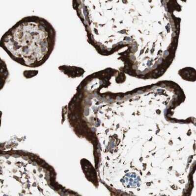 Immunohistochemistry-Paraffin: gp96/HSP90B1/GRP94 Antibody [NBP1-81802]