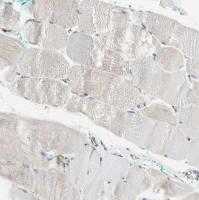 Immunohistochemistry-Paraffin: gp96/HSP90B1/GRP94 Antibody [NBP1-81802]