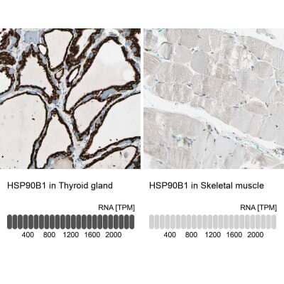 Immunohistochemistry-Paraffin: gp96/HSP90B1/GRP94 Antibody [NBP1-81802]