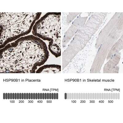 Immunohistochemistry-Paraffin: gp96/HSP90B1/GRP94 Antibody [NBP1-81803]