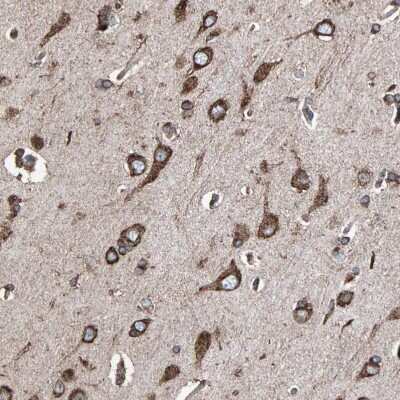 Immunohistochemistry-Paraffin: gp96/HSP90B1/GRP94 Antibody [NBP1-81803]