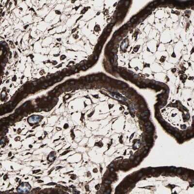 Immunohistochemistry-Paraffin: gp96/HSP90B1/GRP94 Antibody [NBP1-81803]