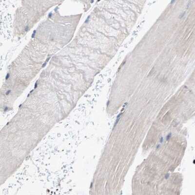Immunohistochemistry-Paraffin: gp96/HSP90B1/GRP94 Antibody [NBP1-81803]