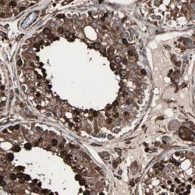 Immunohistochemistry-Paraffin: gp96/HSP90B1/GRP94 Antibody [NBP1-81803]