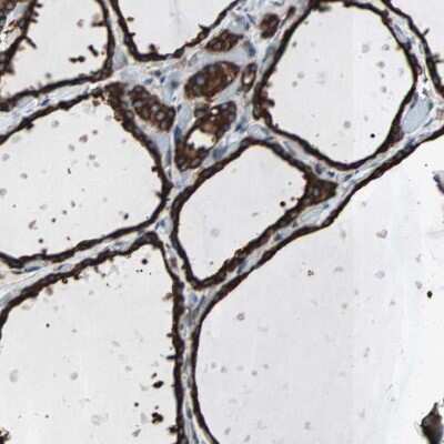 Immunohistochemistry-Paraffin: gp96/HSP90B1/GRP94 Antibody [NBP1-81803]
