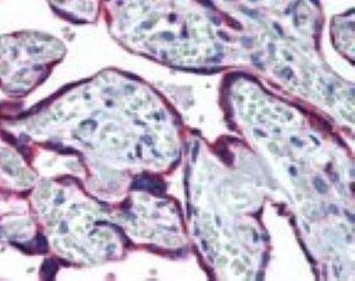Immunohistochemistry-Paraffin: gp96/HSP90B1/GRP94 Antibody [NBP2-24698]