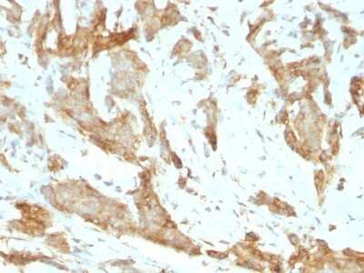 Immunohistochemistry-Paraffin: gp96/HSP90B1/GRP94 Antibody (SPM249) - IHC-Prediluted [NBP2-48051]