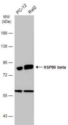 Western Blot: gp96/HSP90B1/GRP94 Antibody [NBP1-32118]