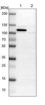Western Blot: gp96/HSP90B1/GRP94 Antibody [NBP1-81802]