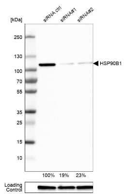 Western Blot: gp96/HSP90B1/GRP94 Antibody [NBP1-81802]