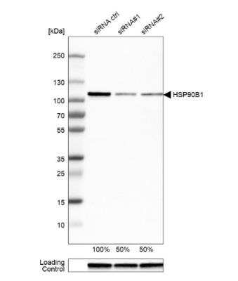 Western Blot: gp96/HSP90B1/GRP94 Antibody [NBP1-81803]