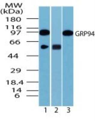 Western Blot: gp96/HSP90B1/GRP94 Antibody [NBP2-24698]