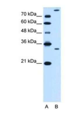 Western Blot: Granzyme K Antibody [NBP1-69353]