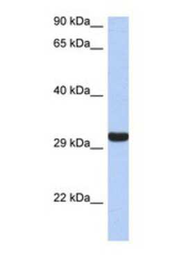 Western Blot: Granzyme K Antibody [NBP1-69548]