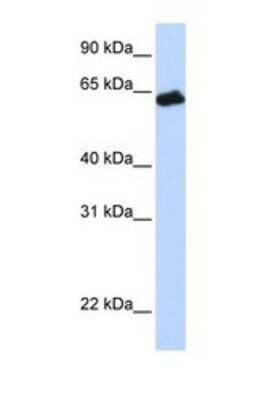 Western Blot: Growth Hormone R Antibody [NBP1-69449]