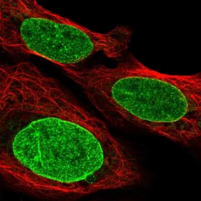 Immunocytochemistry/ Immunofluorescence: gtf3c3 Antibody [NBP2-56032]